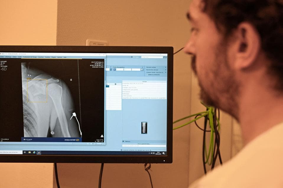 Expertos creen que la IA debería reemplazar a los médicos, no trabajar con ellos